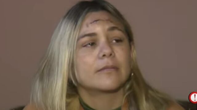 Córdoba: la balearon en un robo, aún tiene el proyectil en la cabeza y teme volver a su casa (El Doce).