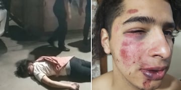 Así le quedó la cara al joven golpeado en Praga.