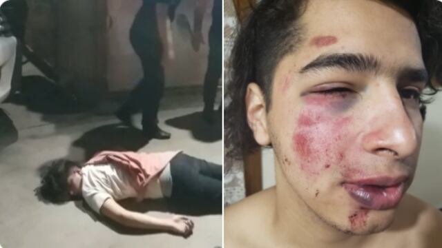 Así le quedó la cara al joven golpeado en Praga.