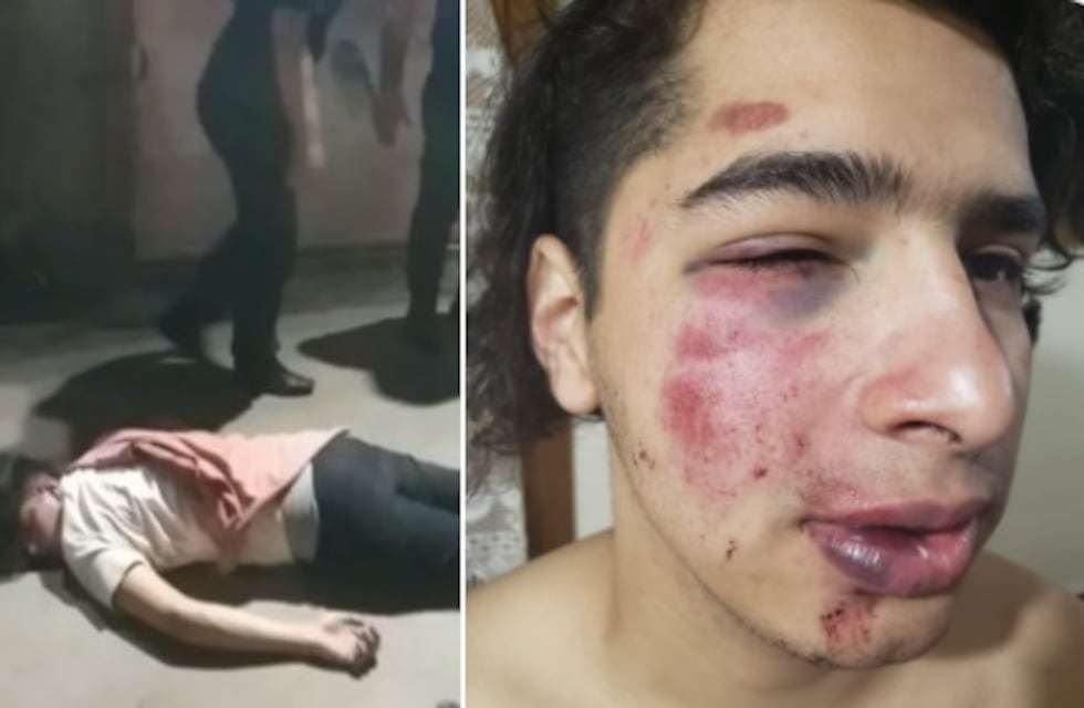 Así golpearon patovicas a un joven en la puerta de un boliche en Mendoza