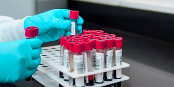 La vacunación no corta la red de contagios