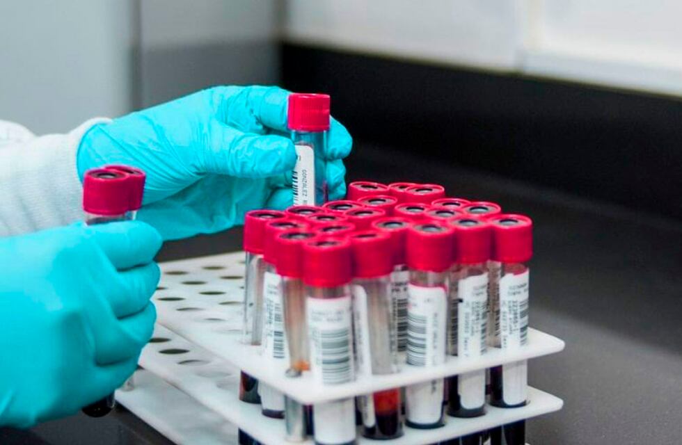 No hubo casos de coronavirus en Pérez