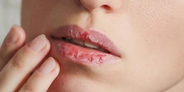 El truco definitivo para reparar los labios resecos en invierno: la técnica con solo dos productos