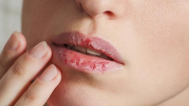 El truco definitivo para reparar los labios resecos en invierno: la técnica con solo dos productos