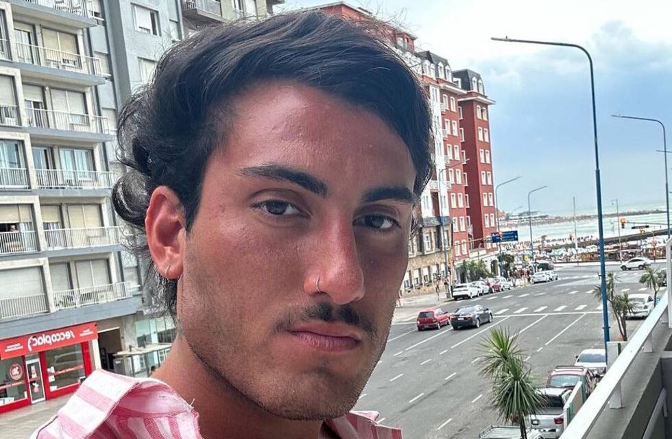 El antes y después de Tomás Holder: su mandíbula es por genética o “intervención” médica