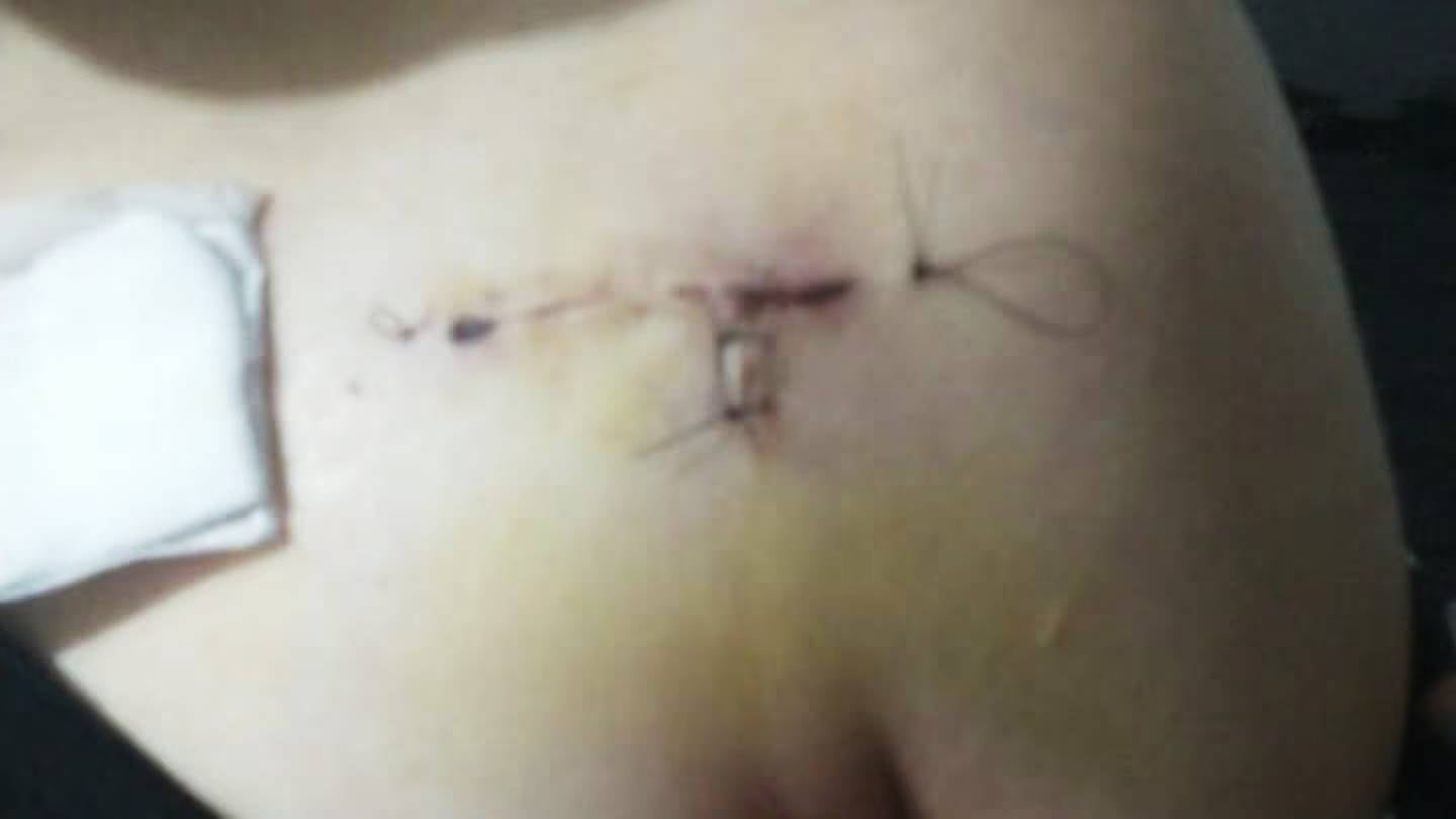 Violenta agresión a adolescente en Córdoba. Su familia clama por justicia. (El Doce)