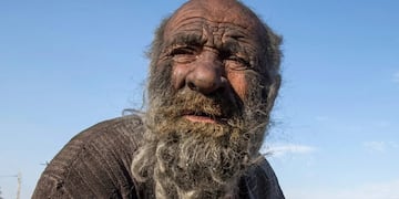 Amou Haji, "el hombre más sucio del mundo".