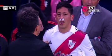 La condición de Aliendro después del golpe