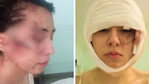 Joven brutalmente atacada en Santa Fe