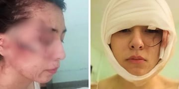 Joven brutalmente atacada en Santa Fe