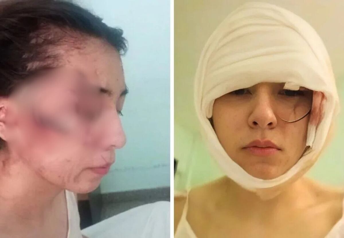 “La querían matar”: habló la madre de la adolescente atacada por una patota en Santa Fe