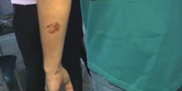 Uno de los efectivos agredidos en barrio Argüello Lourdes,