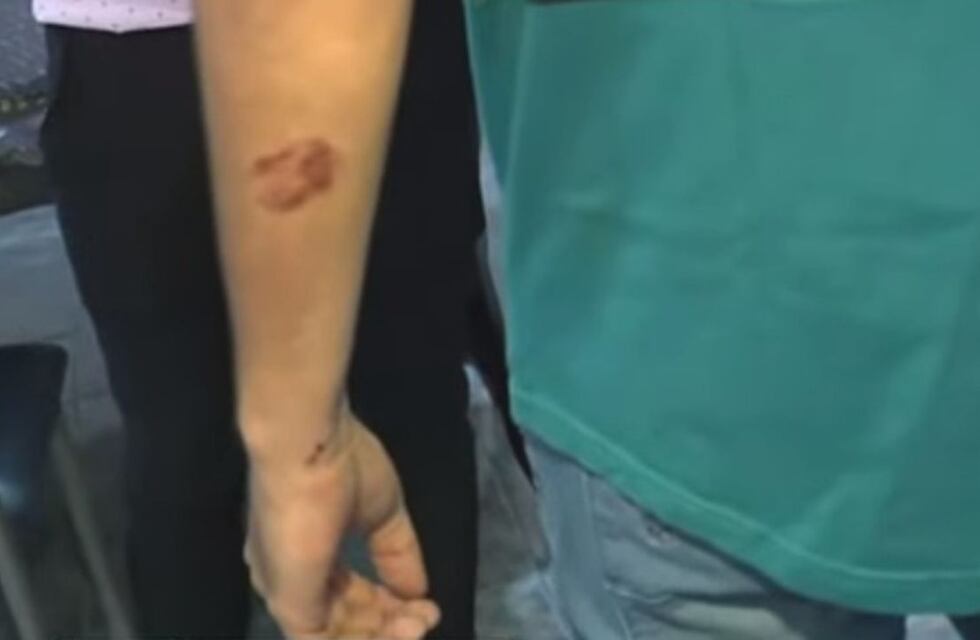 Córdoba: Uno de los policías mordidos por un ladrón y su familia recordó lo ocurrido