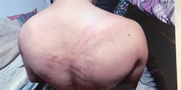 Denunció que policías le pusieron una media en la boca y lo golpearon hasta hacerlo llorar