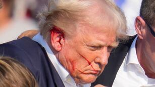 El empresario de 78 años recibió ayuda de agentes de Servicio Secreto apenas advirtió que estaba herido.