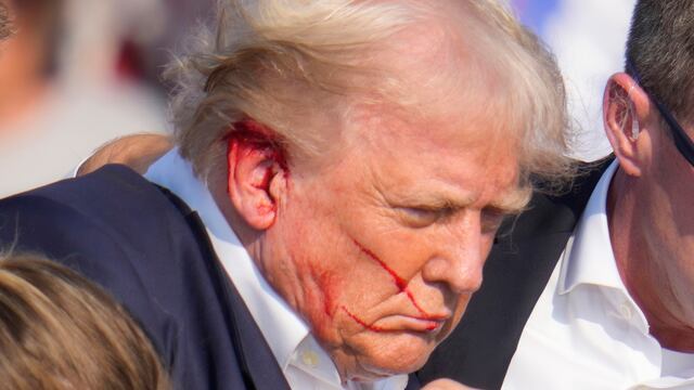 El empresario de 78 años recibió ayuda de agentes de Servicio Secreto apenas advirtió que estaba herido.