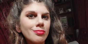 La joven de 29 años tiene casi 400 mil seguidores en Instagram.