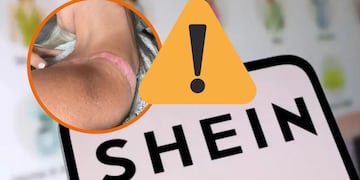 Compró un top en Shein por $7.000 y terminó con una quemadura que podría dejarle cicatriz
