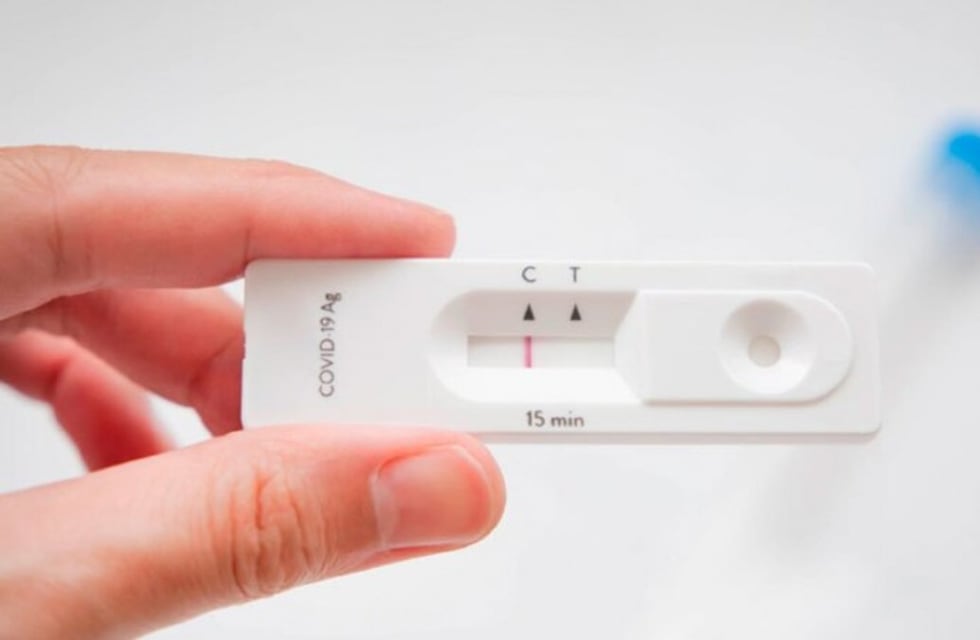 COVID-19: el Gobierno estableció cómo deberán usarse e informarse los autotest