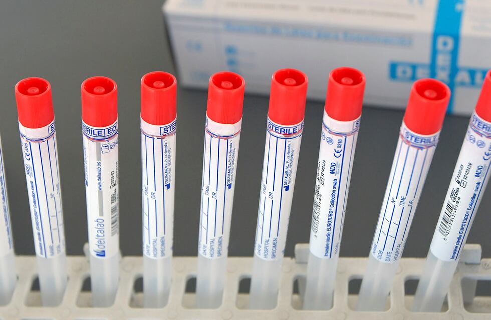 Arroyito cuenta con 22 casos positivos de Covid-19 en la actualidad