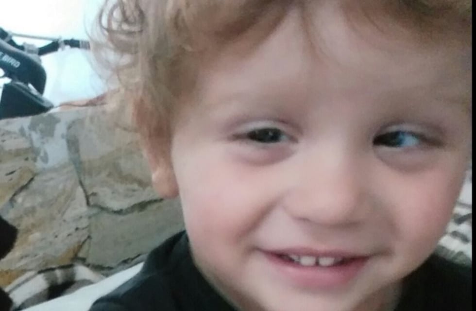 La Plata: un nene padece una enfermedad en los ojos y necesita ayuda