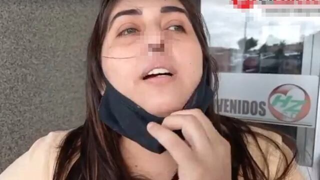 Claudia Serran denuncia que por un hisopado mal realizado se le deshizo el cartílago.