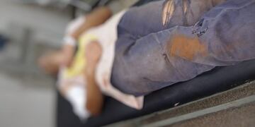 Un recolector de residuos fue atacado por un pitbull en Eldorado.