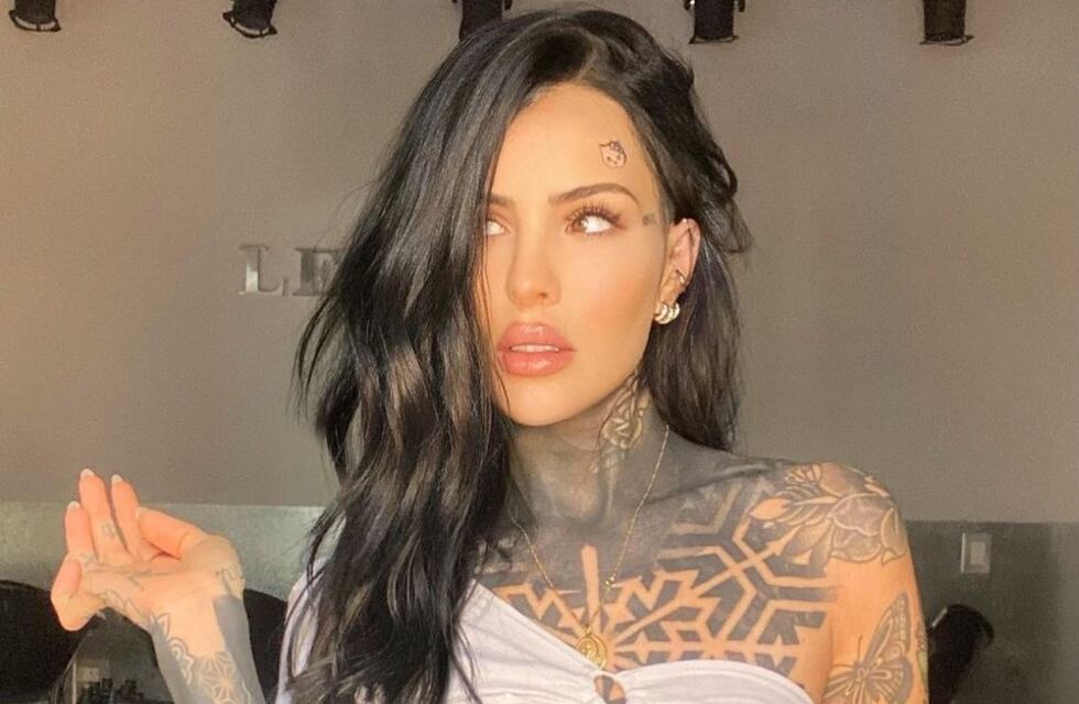 Cande Tinelli se operó la nariz y lo mostró en Instagram: “Más corrida que la torre de Pisa”