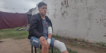 El joven fue atacado por una jauría de perros en barrio San Roque. (El Doce Tv)