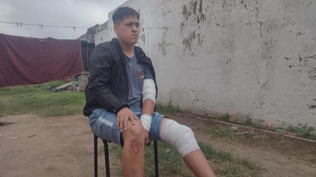 El joven fue atacado por una jauría de perros en barrio San Roque. (El Doce Tv)
