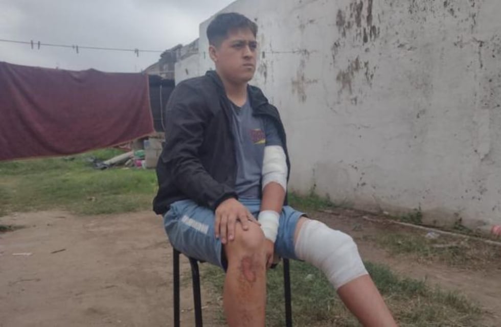 Córdoba: habló el joven que fue atacado por una jauría de perros y se salvó de milagro