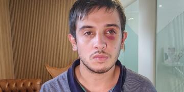 El joven fue atacado en un boliche de Villa Allende. (Foto: Telefe)