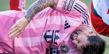 Confirmaron que Lionel Messi está lesionado.
