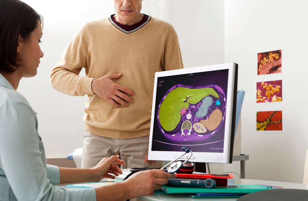 Día Mundial contra la Hepatitis: por qué se celebra, las cinco principales formas de prevenirla y de tratarla