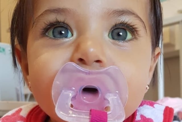 Vecinos venden bonos para ayudar a Zoe y a su familia