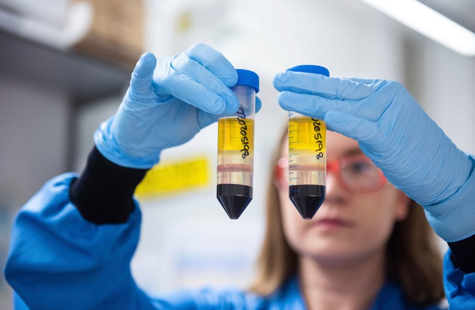 La vacuna de Oxford-Astrazeneca es eficaz en un 67% con una dosis, y llega a 82% con la segunda
