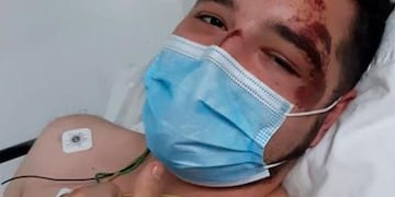 Lo atacaron unos salvajes, para quitarle el celular y casi lo matan.