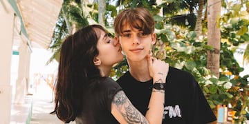 Muy enamorado: Felipe Fort se tatuó la mordida de su novia y el video se hizo viral.