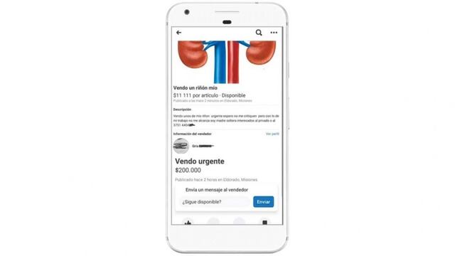Insólito: publicó en redes sociales que vende su riñón.