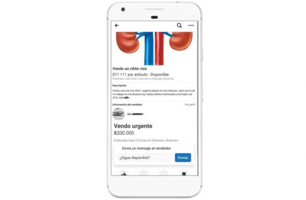 Insólito: publicó en redes sociales que vende su riñón