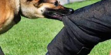 Espeluznante ataque canino sobre una joven de la ciudad.