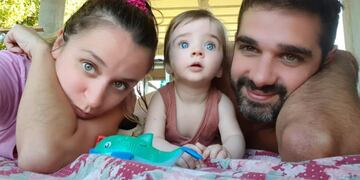 La pequeña fue diagnosticada cuando notaron sus dificultades para empezar a caminar. (Gisela Basualdo)