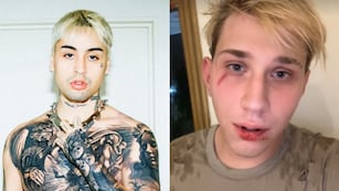 La palabra de Tiago PZK, tras ser acusado de golpear a un youtuber en el baño de un boliche