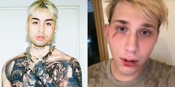 La palabra de Tiago PZK, tras ser acusado de golpear a un youtuber en el baño de un boliche