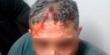 Delivery atacado en Alta Córdoba.