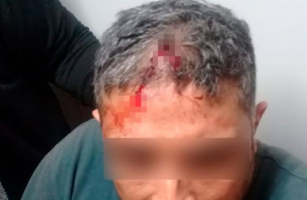 Un delivery fue atacado a ladrillazos por delincuentes en Córdoba: tuvo que ser atendido de urgencia