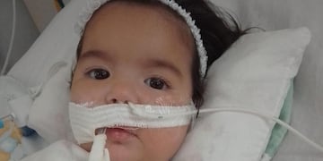Anita, la beba de Laboulaye que necesita de la ayuda de todos. (Puntal.com)