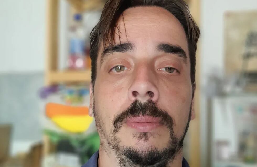 Un ex “Cuestión de Peso” pide ayuda económica para una cirugía reconstructiva tras bajar 140 kilos