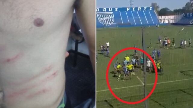 Jugadores de la cuarta división de Godoy Cruz agredieron a la terna arbitral en la final de la división de la Liga Mendocina.