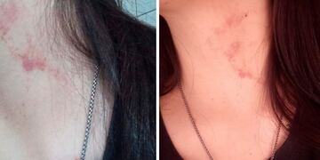 Un viceintendente del departamento fue denunciado por presunta violencia contra su novia